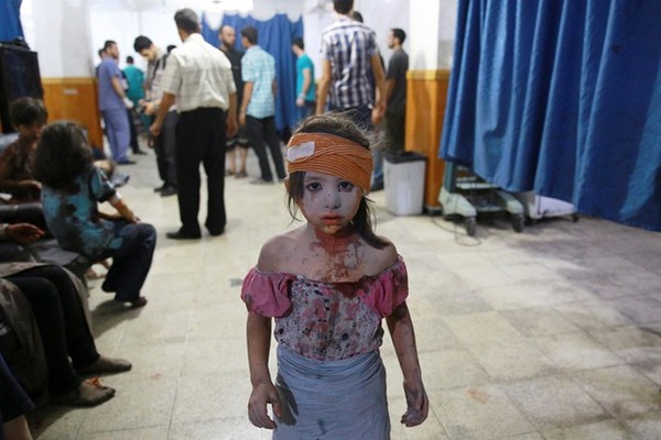 Một bé gái Syria bị thương đang chờ được điều trị tại bệnh viện dã chiến ở thị trấn Douma, phía đông thủ đô Damascus, ngày 22/8/2015. Phe nổi dậy đang chiếm giữ thị trấn này. Sau hơn 4 năm nội chiến, Syria chìm trong những những vụ xung đột bạo lực triền miên giữa quân đội chính phủ và phe nổi dậy. Ảnh: AFP